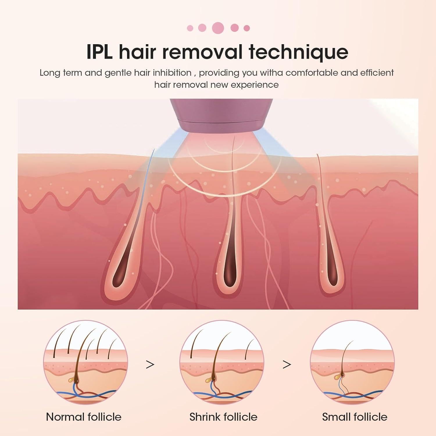 IPL Hair Remover